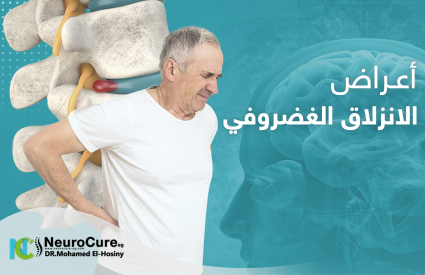 اعراض انزلاق الغضروف