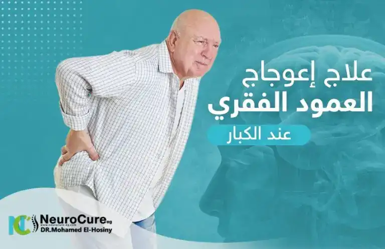 علاج اعوجاج العمود الفقري عند الكبار 768x497 1