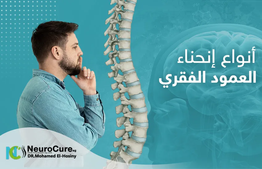 أنواع انحناء العمود الفقري