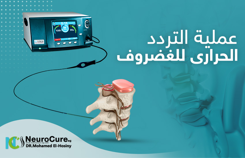 عملية التردد الحرارى للغضروف