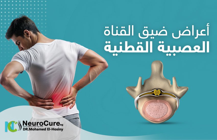 تعرف إلى أعراض ضيق القناة العصبية القطنية