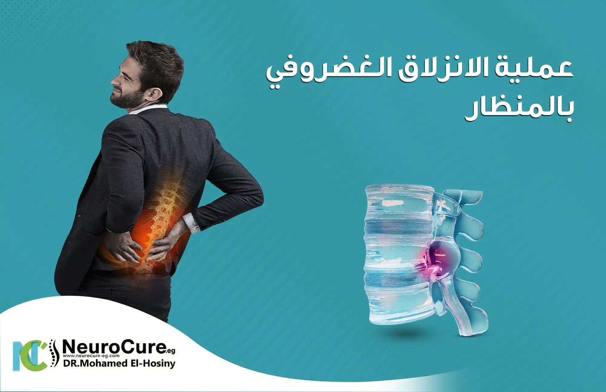 علاج الانزلاق الغضروفي بالمنظار