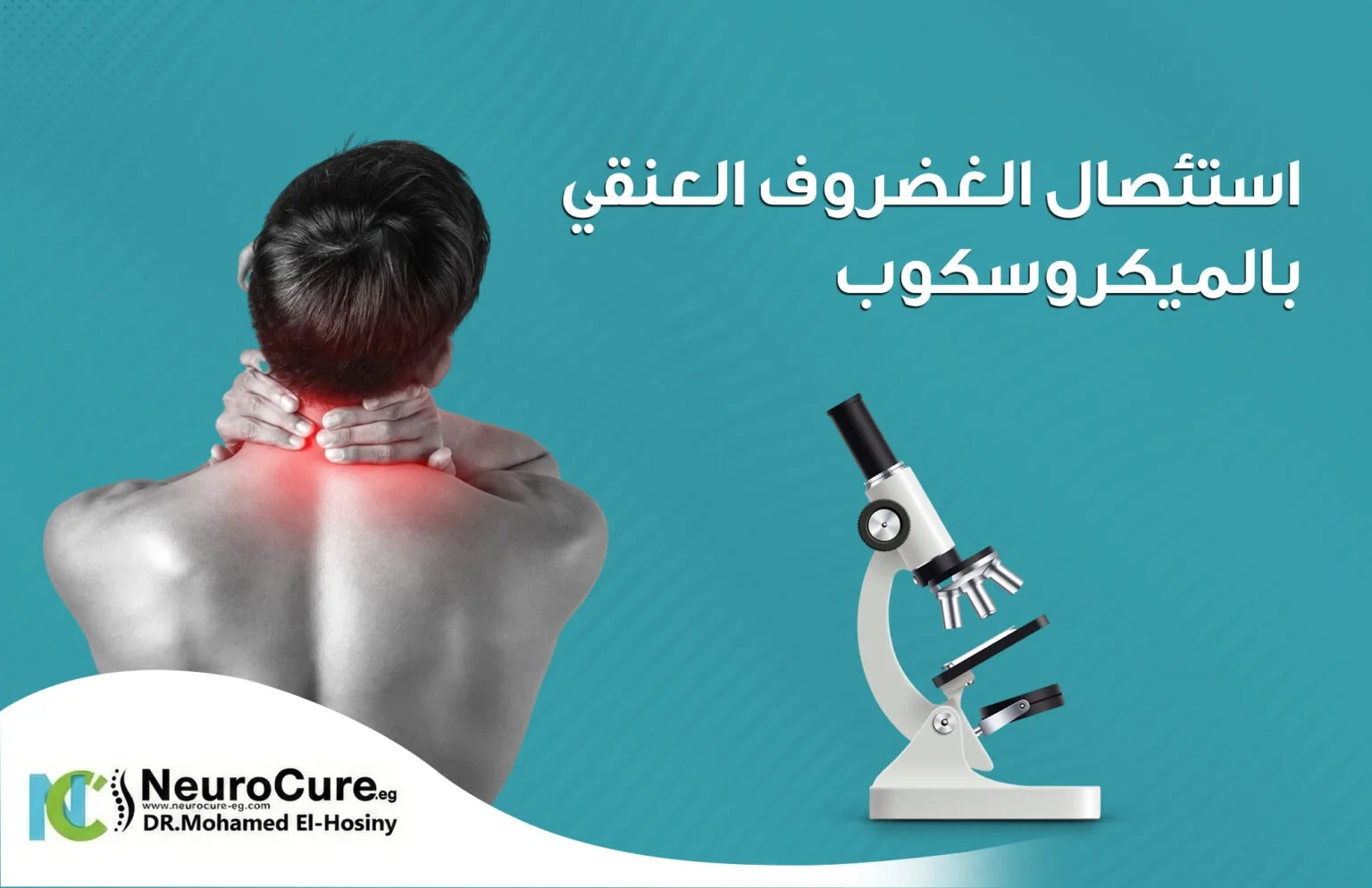 استئصال الغضروف العنقي بالميكروسكوب