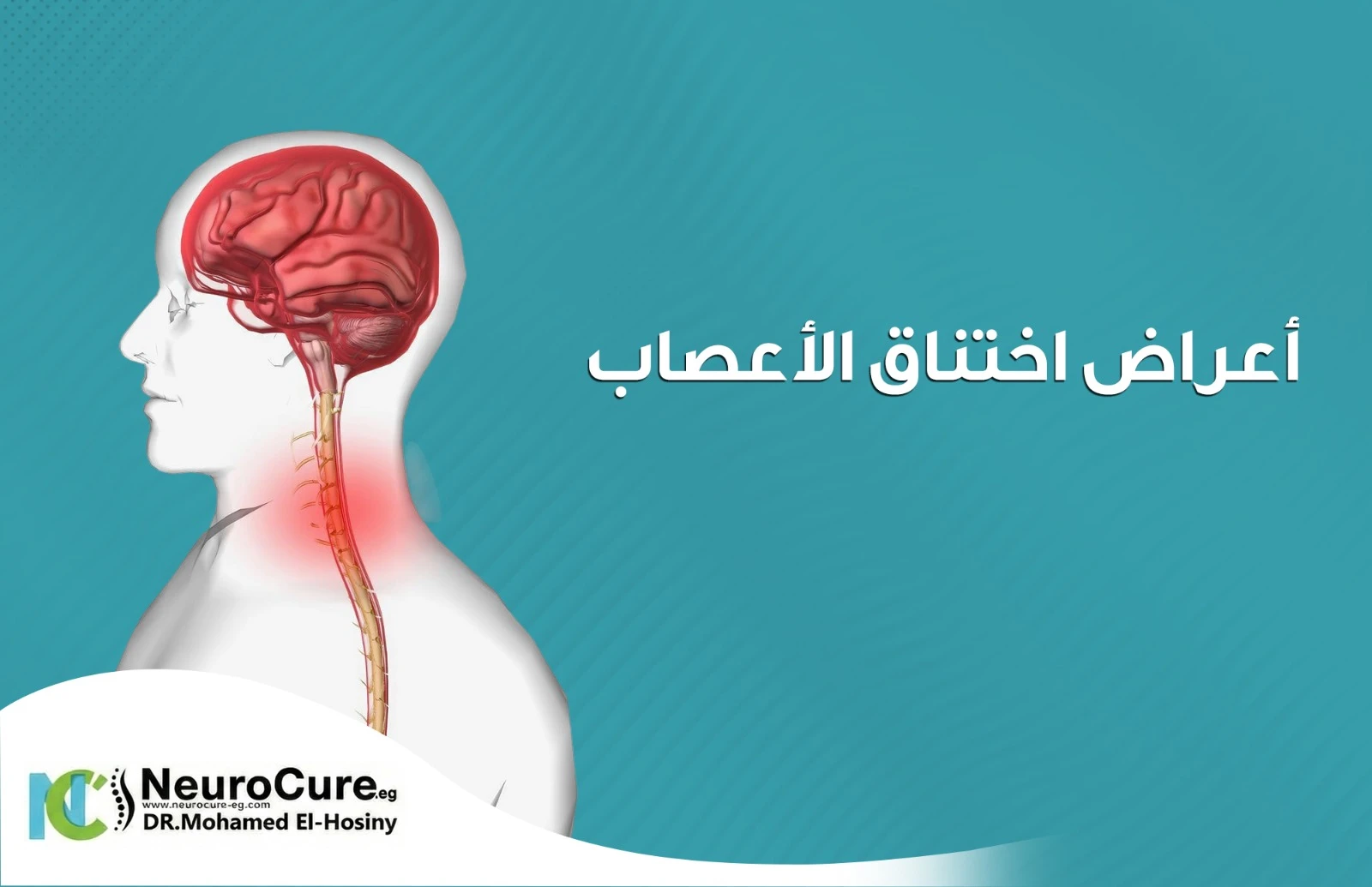 أعراض اختناق الأعصاب