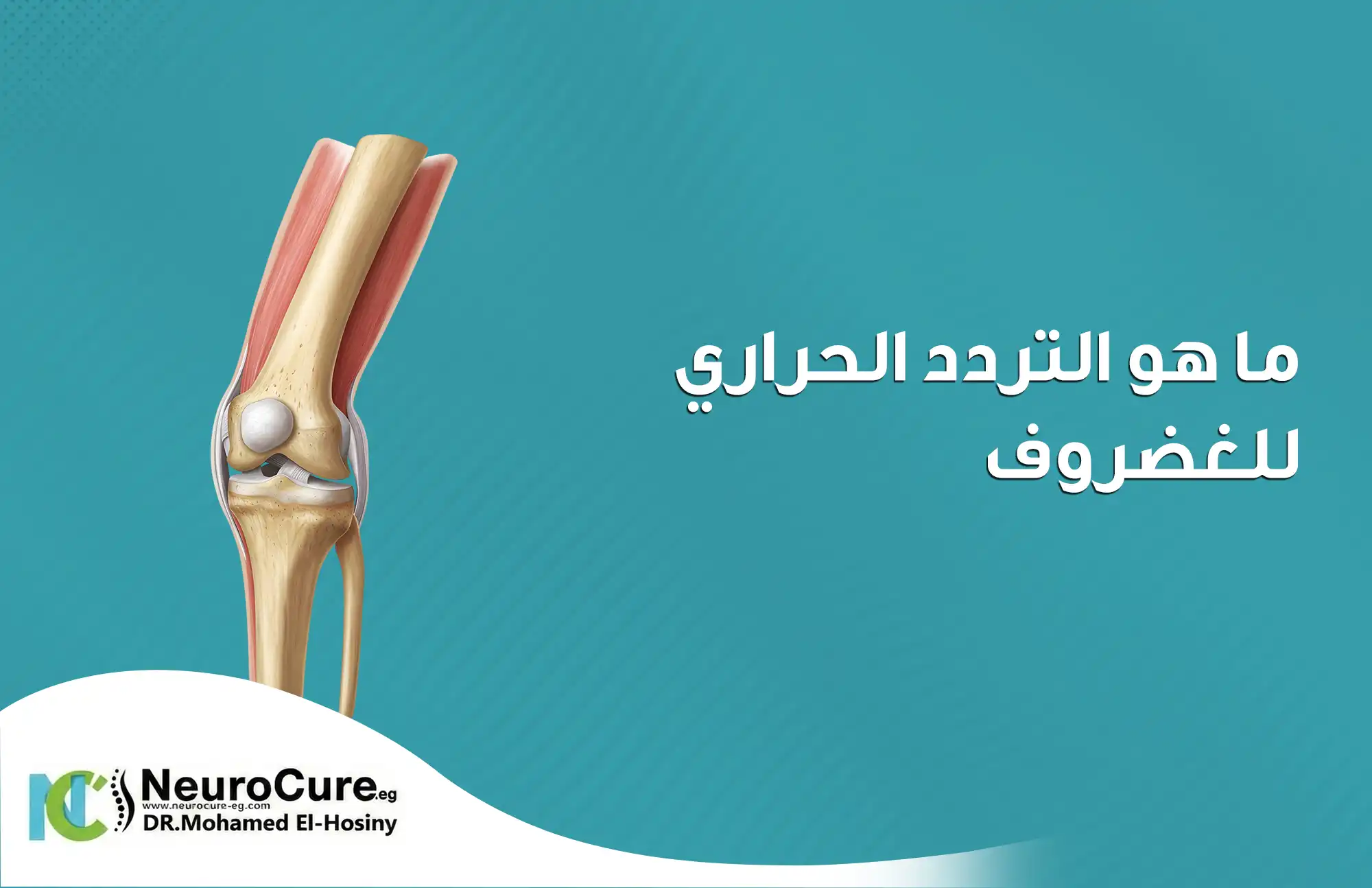 ما هو التردد الحراري للغضروف