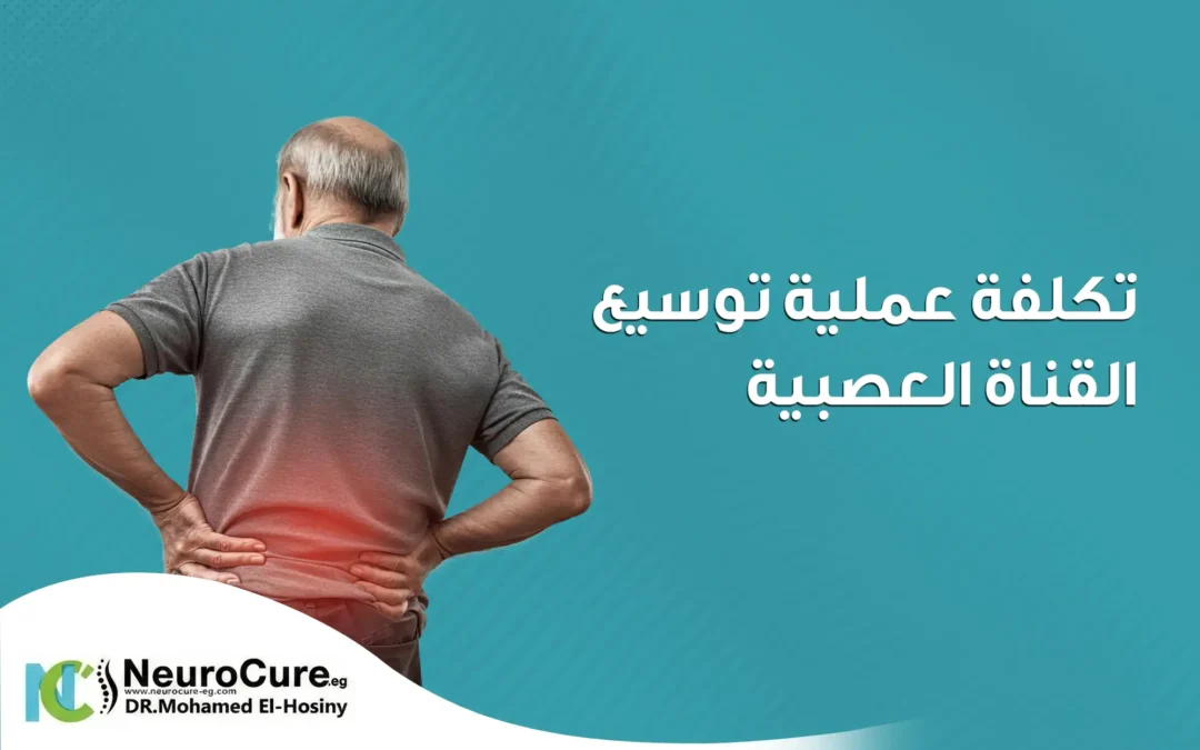 تكلفة عملية توسيع القناة العصبية وأهم العوامل المؤثرة عليها