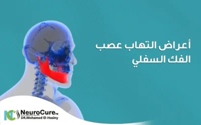 أعراض التهاب عصب الفك السفلي | الأسباب وطرق العلاج الفعالة 