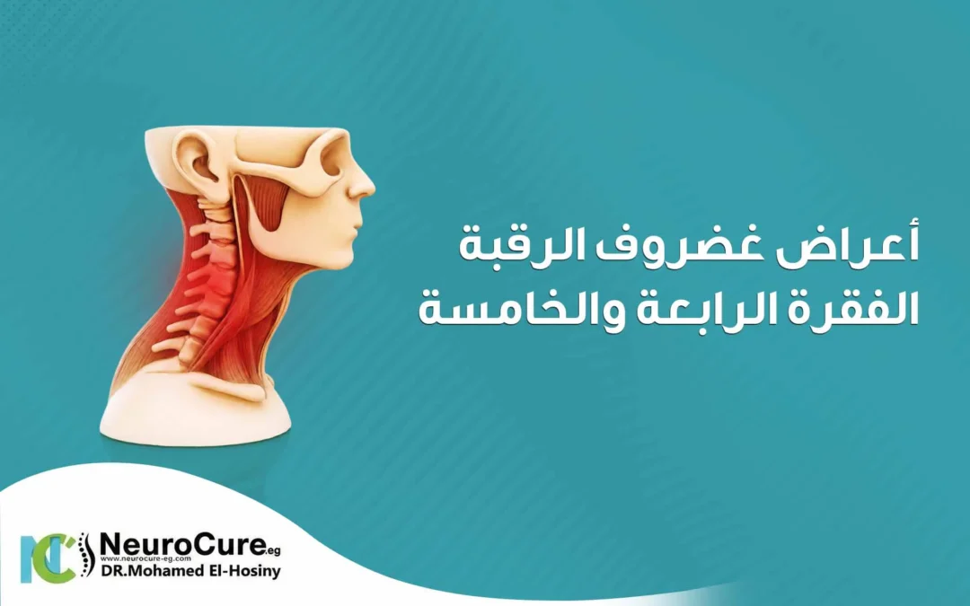 أعراض غضروف الرقبة الفقرة الرابعة والخامسة وكيفية العلاج 
