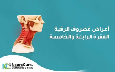 أعراض غضروف الرقبة الفقرة الرابعة والخامسة وكيفية العلاج 