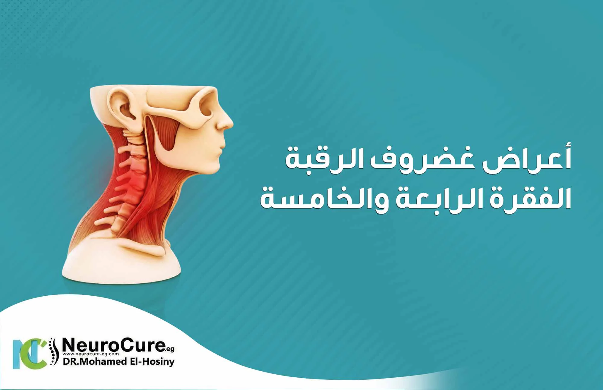 أعراض غضروف الرقبة الفقرة الرابعة والخامسة