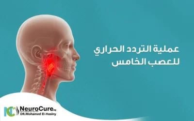 عملية التردد الحراري للعصب الخامس | المزايا والنتائج المتوقعة 