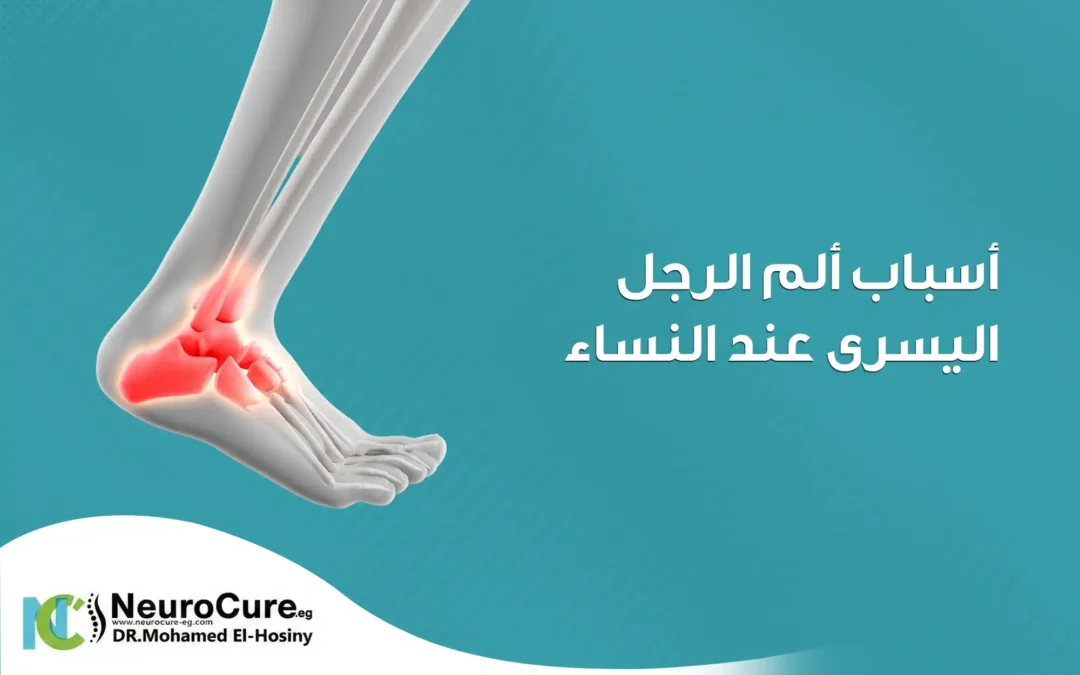 أسباب ألم الرجل اليسرى عند النساء ومتى يستدعي العلاج؟