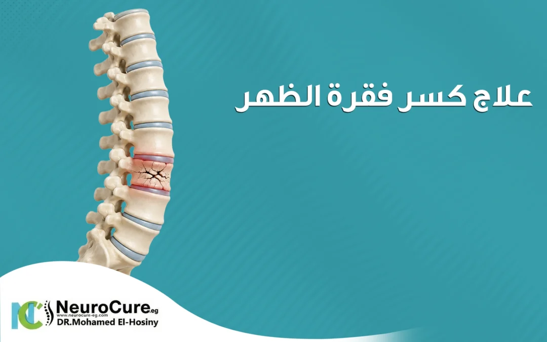 علاج كسر فقرة الظهر